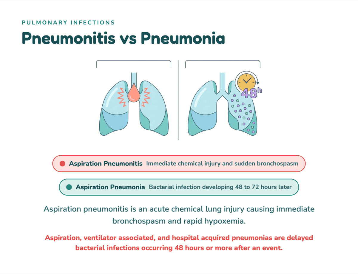 Illustrated teaching card comparing aspiration pneumonitis and aspiration pneumonia, with lung illustrations and a 48-hour onset callout